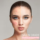 SkinGlow Digital Electric Cleanser Pro - Limited Edition