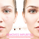 SkinGlow Digital Electric Cleanser Pro - Limited Edition