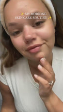 SkinGlow Electric Cleanser - No More Blackheads